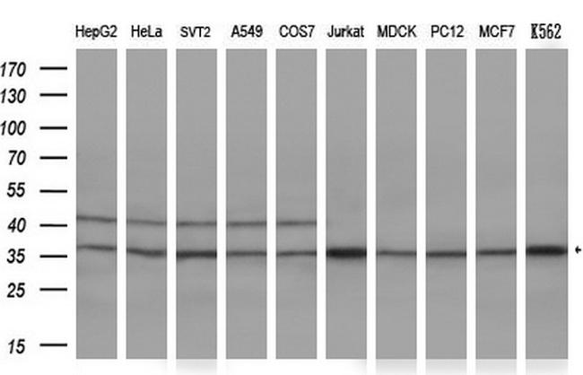 GTF2B Antibody in Western Blot (WB)