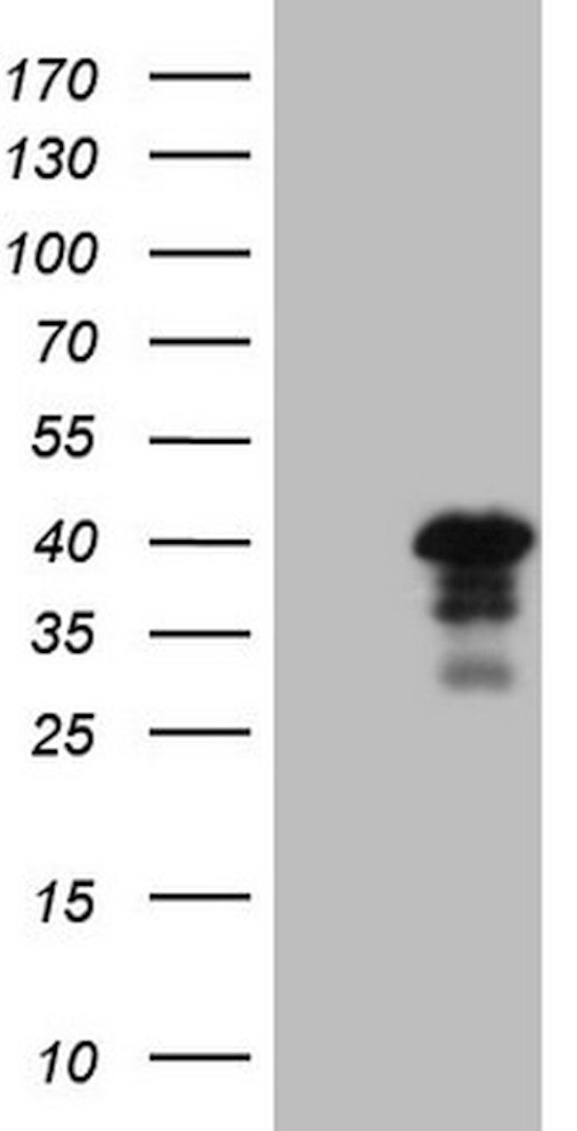 GTF2B Antibody in Western Blot (WB)