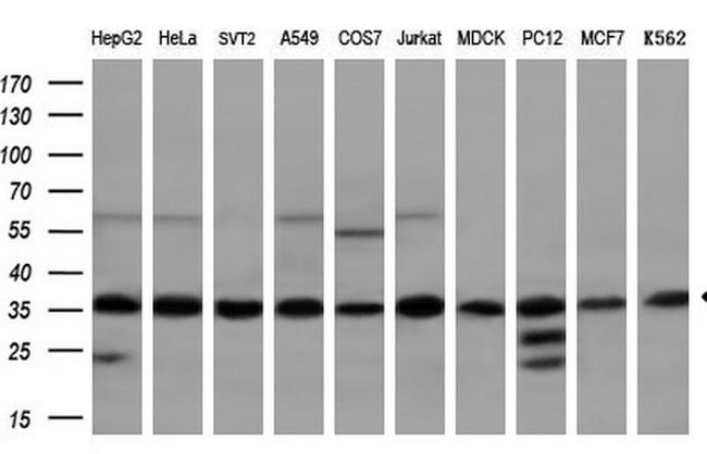 GTF2B Antibody in Western Blot (WB)