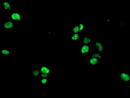 GTF2F1 Antibody in Immunocytochemistry (ICC/IF)