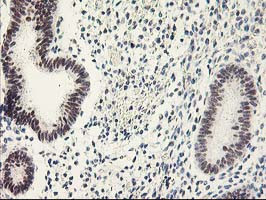 GTF2F1 Antibody in Immunohistochemistry (Paraffin) (IHC (P))