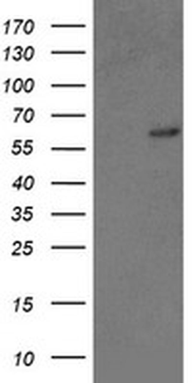 GTF2F1 Antibody in Western Blot (WB)