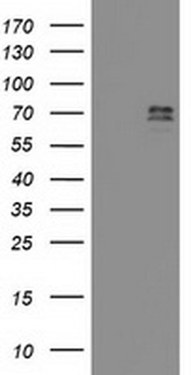 GTF2F1 Antibody in Western Blot (WB)