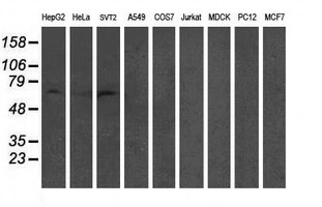 GTF2F1 Antibody in Western Blot (WB)