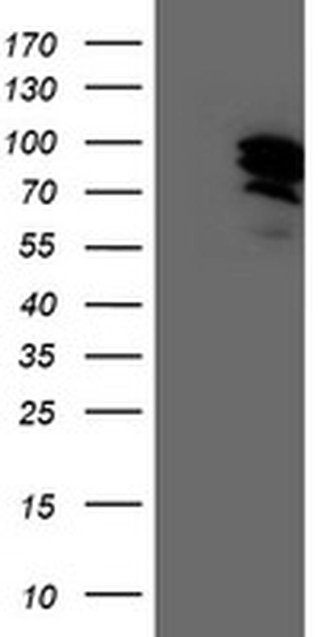 GTF2F1 Antibody in Western Blot (WB)