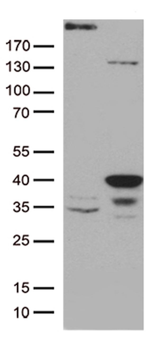 GTF2H3 Antibody in Western Blot (WB)