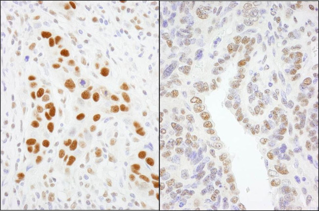 GTF2I/TFII-I Antibody in Immunohistochemistry (IHC)