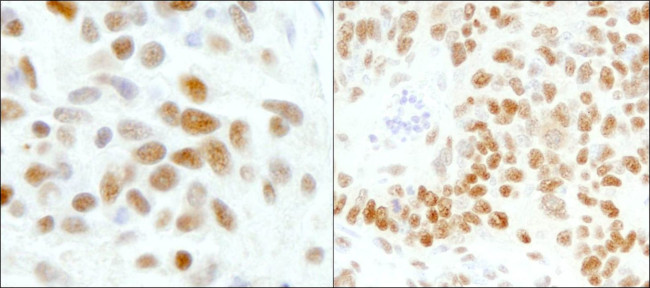 GTF2I/TFII-I Antibody in Immunohistochemistry (IHC)