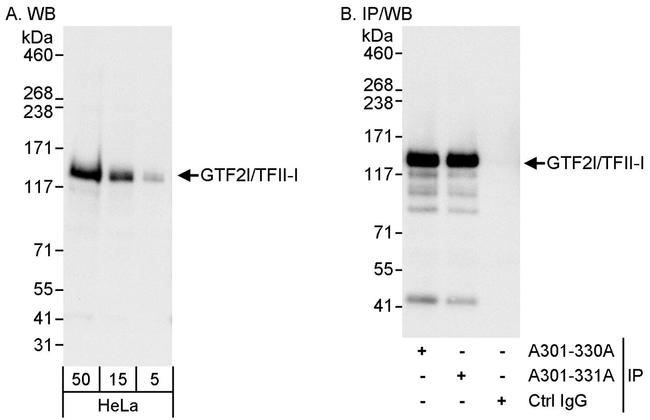 GTF2I/TFII-I Antibody in Western Blot (WB)