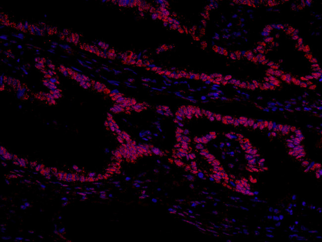 GTF2I/TFII-I Antibody in Immunohistochemistry (IHC)