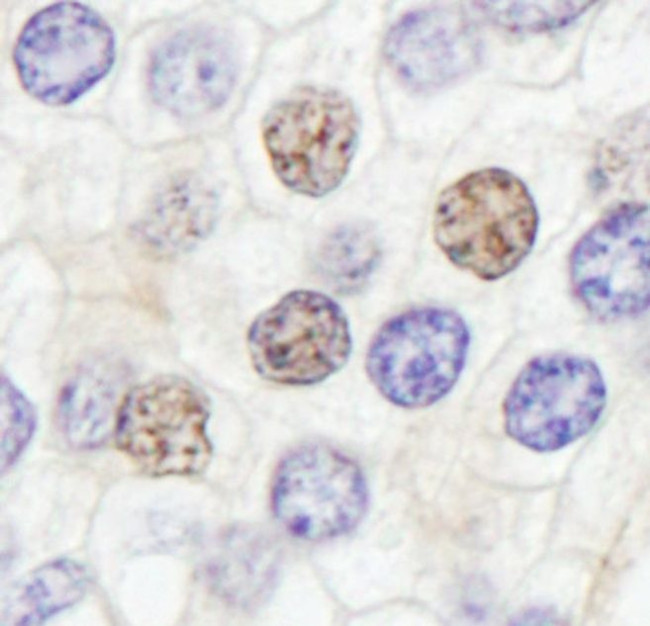 GTF2IRD/TFII-IRD1 Antibody in Immunohistochemistry (IHC)