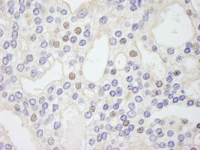 GTF2IRD/TFII-IRD1 Antibody in Immunohistochemistry (IHC)