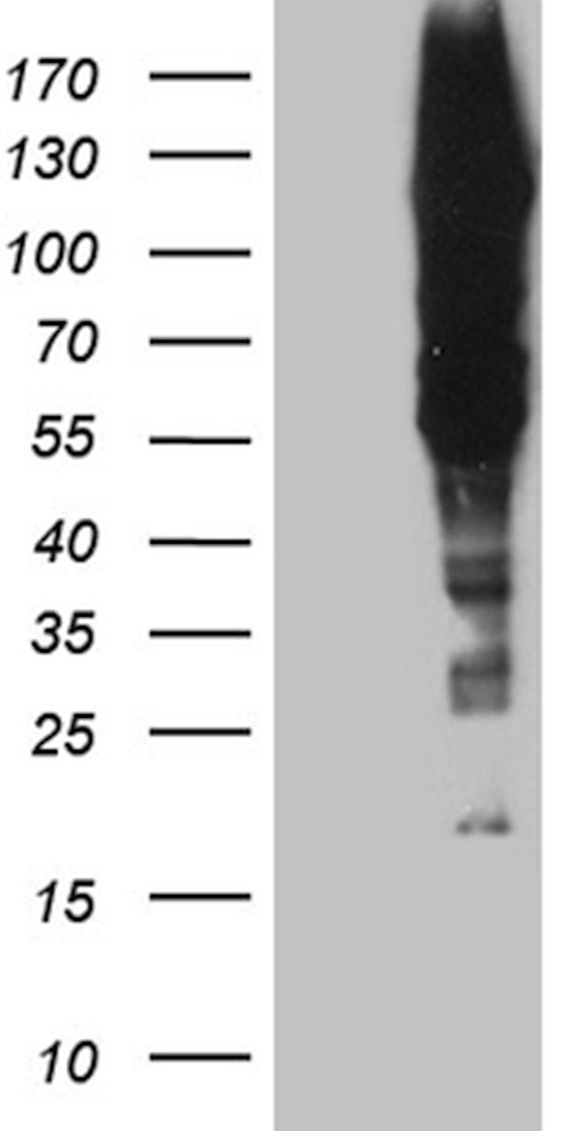 GTF2IRD1 Antibody in Western Blot (WB)