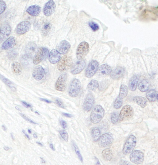 GTF3C1/TFIIIC220 Antibody in Immunohistochemistry (IHC)