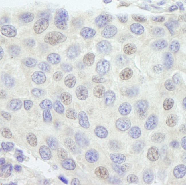 GTF3C1/TFIIIC220 Antibody in Immunohistochemistry (IHC)