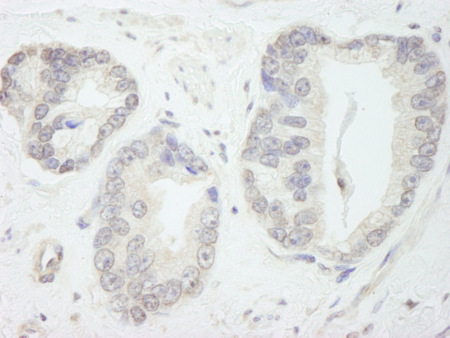 GTF3C1/TFIIIC220 Antibody in Immunohistochemistry (IHC)