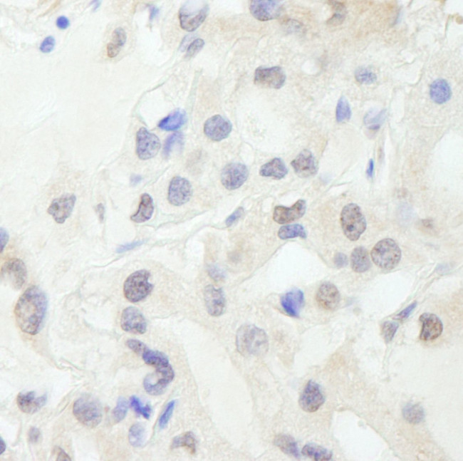 GTF3C1/TFIIIC220 Antibody in Immunohistochemistry (IHC)