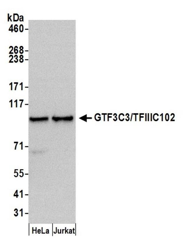 GTF3C3/TFIIIC102 Antibody in Western Blot (WB)