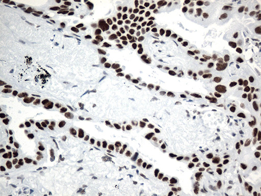 GTF3C4 Antibody in Immunohistochemistry (Paraffin) (IHC (P))