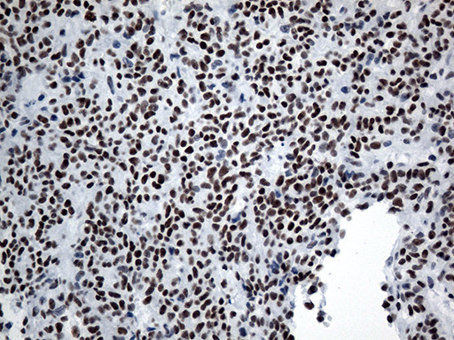 GTF3C4 Antibody in Immunohistochemistry (Paraffin) (IHC (P))