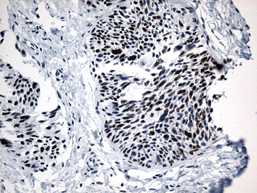 GTF3C4 Antibody in Immunohistochemistry (Paraffin) (IHC (P))