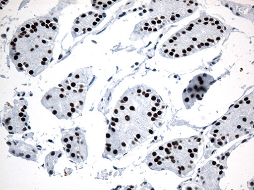 GTF3C4 Antibody in Immunohistochemistry (Paraffin) (IHC (P))