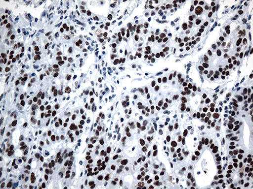 GTF3C4 Antibody in Immunohistochemistry (Paraffin) (IHC (P))