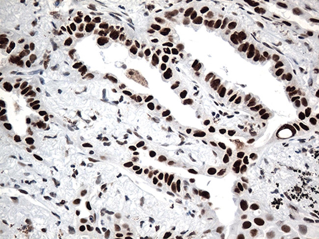 GTF3C4 Antibody in Immunohistochemistry (Paraffin) (IHC (P))