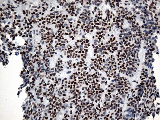 GTF3C4 Antibody in Immunohistochemistry (Paraffin) (IHC (P))