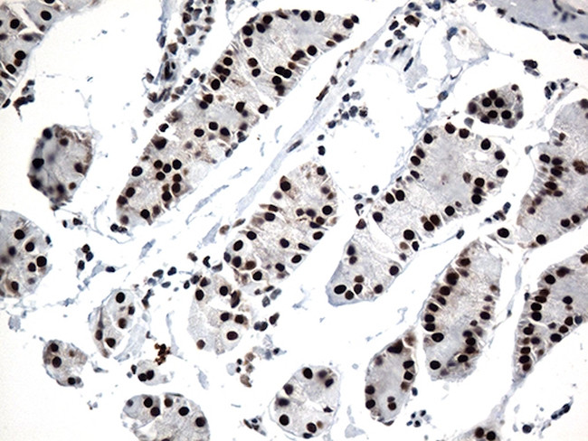 GTF3C4 Antibody in Immunohistochemistry (Paraffin) (IHC (P))