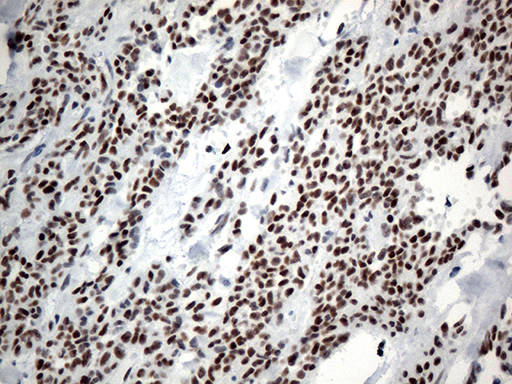 GTF3C4 Antibody in Immunohistochemistry (Paraffin) (IHC (P))