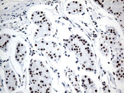 GTF3C4 Antibody in Immunohistochemistry (Paraffin) (IHC (P))