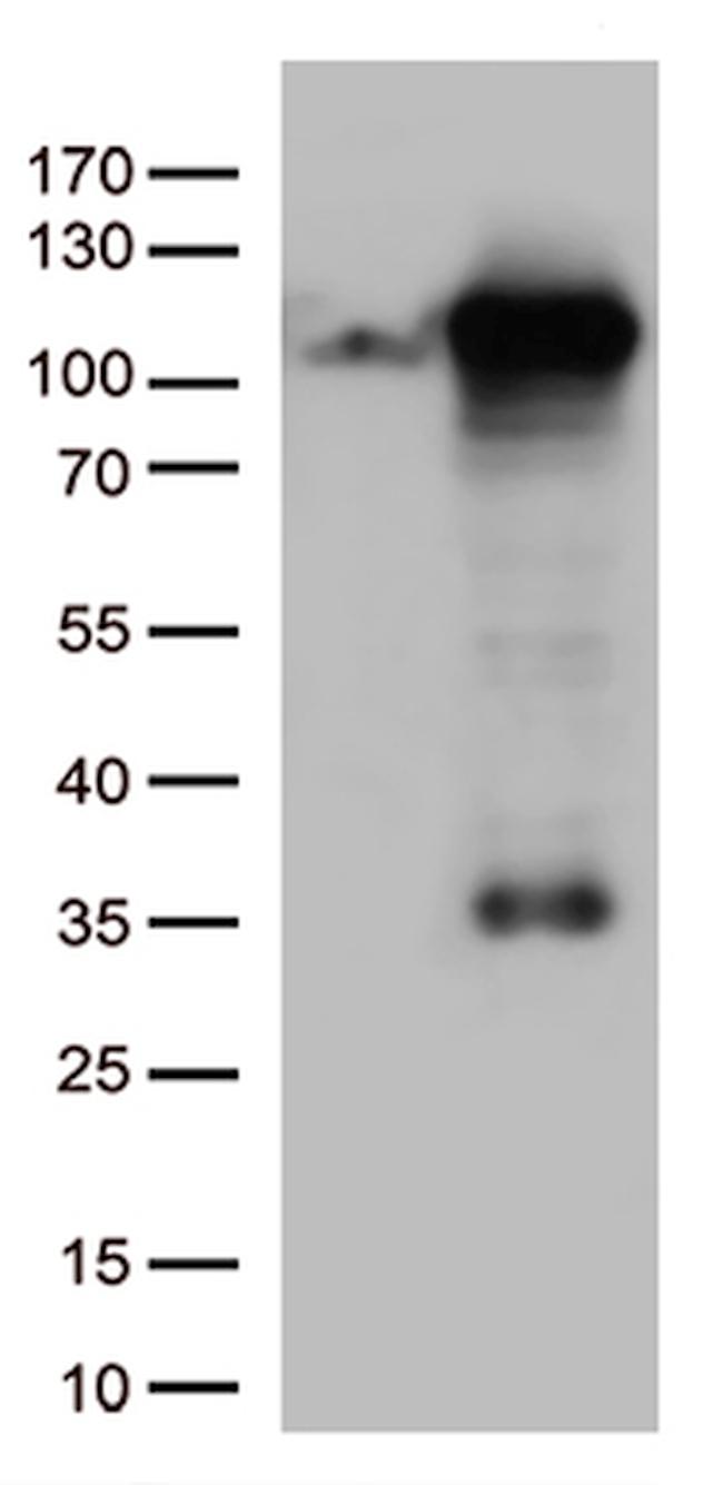 GTF3C4 Antibody in Western Blot (WB)