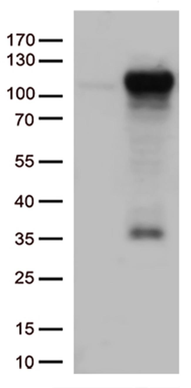 GTF3C4 Antibody in Western Blot (WB)