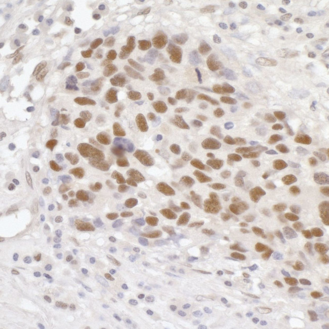 GTF3C5/TFIIIC63 Antibody in Immunohistochemistry (IHC)