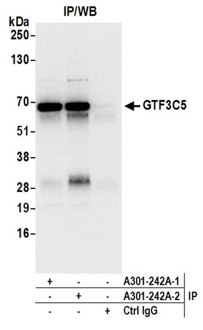 GTF3C5/TFIIIC63 Antibody in Western Blot (WB)