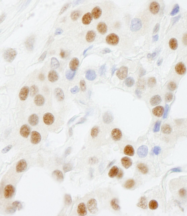 GTF3C5/TFIIIC63 Antibody in Immunohistochemistry (IHC)