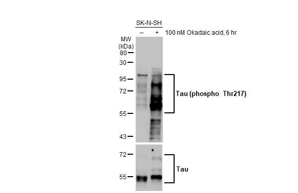 Phospo-Tau (Thr217) Antibody in Western Blot (WB)
