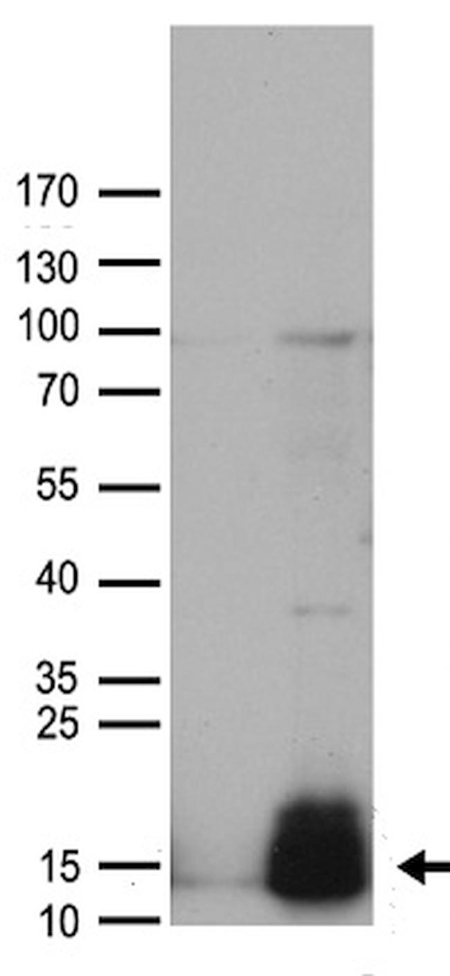 GUCA2A Antibody in Western Blot (WB)