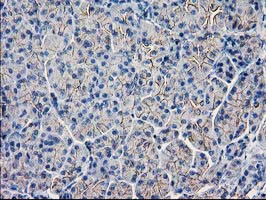 GUK1 Antibody in Immunohistochemistry (Paraffin) (IHC (P))