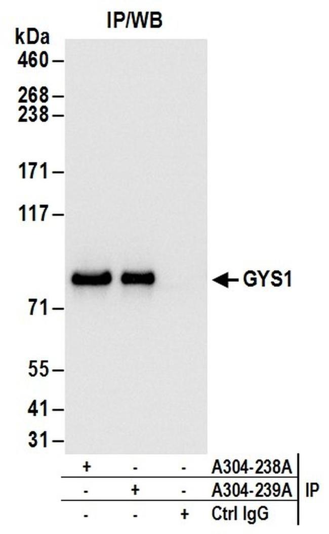 GYS1 Antibody in Western Blot (WB)