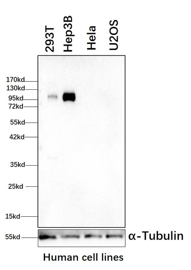 GYS2 Antibody in Western Blot (WB)