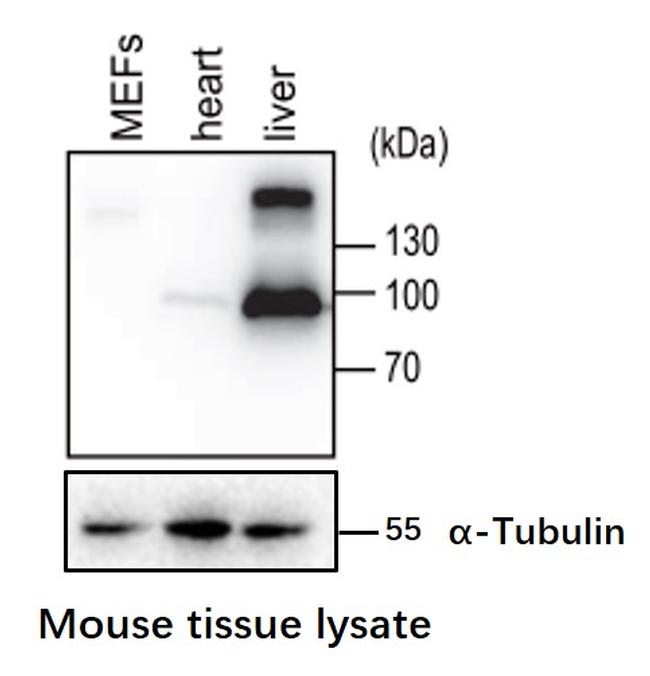 GYS2 Antibody in Western Blot (WB)