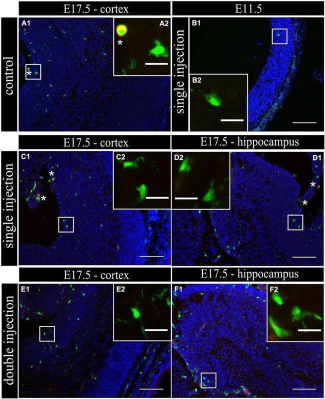 Galectin 3 Antibody in Immunohistochemistry (IHC)