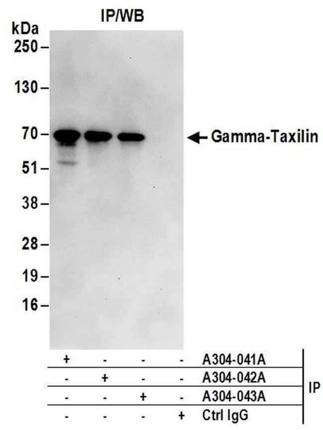 Gamma-Taxilin Antibody in Western Blot (WB)