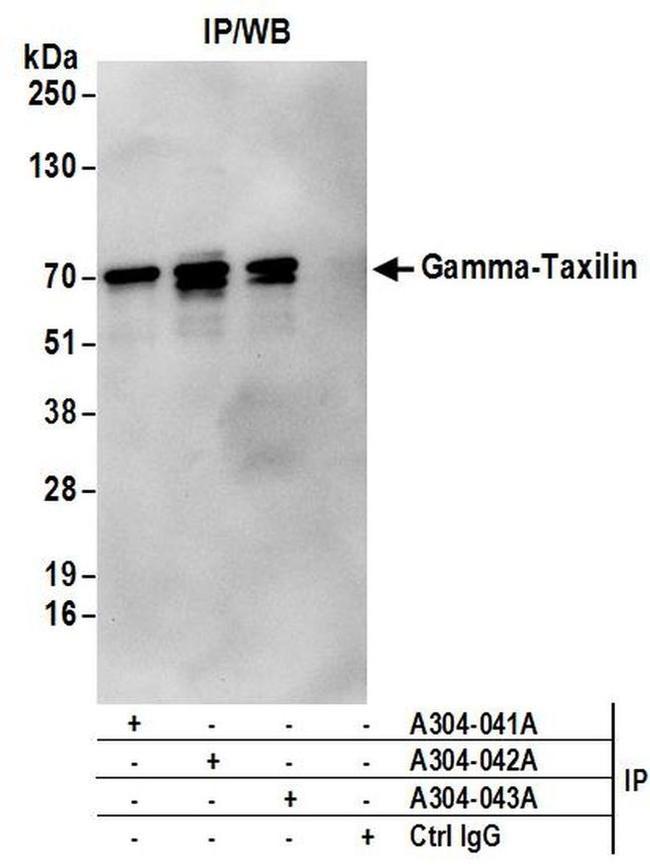 Gamma-Taxilin Antibody in Western Blot (WB)