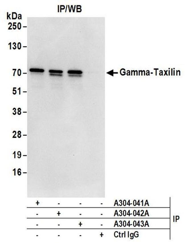 Gamma-Taxilin Antibody in Western Blot (WB)