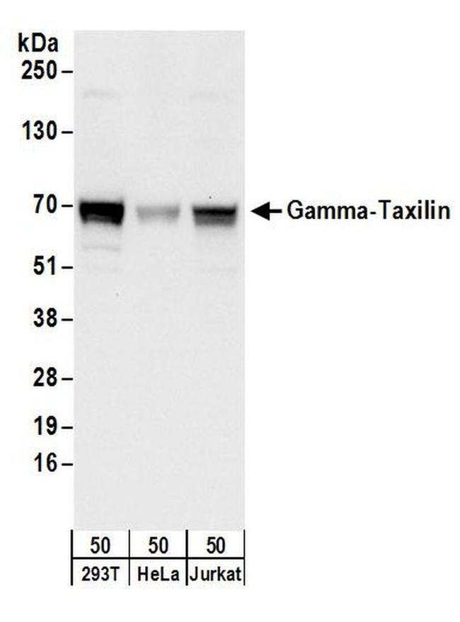 Gamma-Taxilin Antibody in Western Blot (WB)