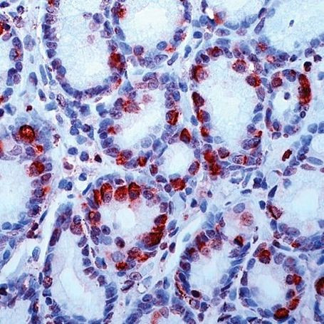 Gastrin Antibody in Immunohistochemistry (Paraffin) (IHC (P))