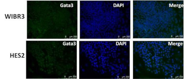 GATA3 Antibody in Immunocytochemistry (ICC/IF)